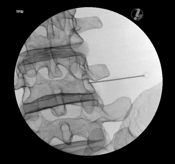 Modele zabiegowe 3B Scientific P65