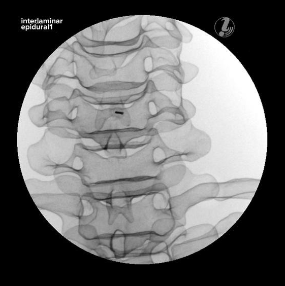 Modele zabiegowe 3B Scientific P67