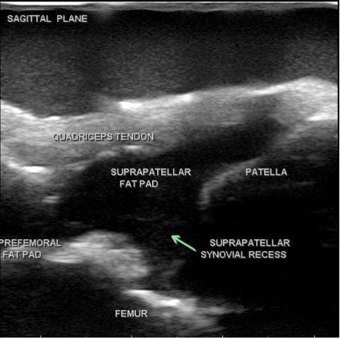 Modele zabiegowe CAE Healthcare Blue Phantom MSK