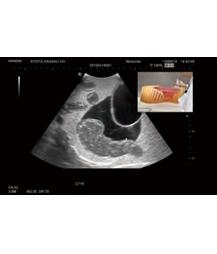 Modele zabiegowe Kyoto Kagaku KKUS-7