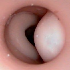 Modele zabiegowe Laerdal Symulator badania per rectum