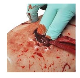 Modele zabiegowe Luna inc. TrueClot