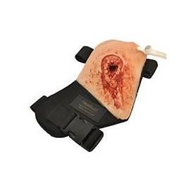 Modele zabiegowe Luna inc. TrueClot