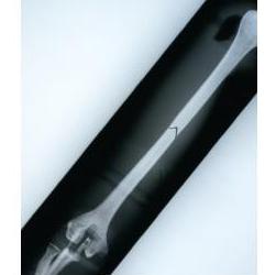 Modele zabiegowe Nasco LF01210U