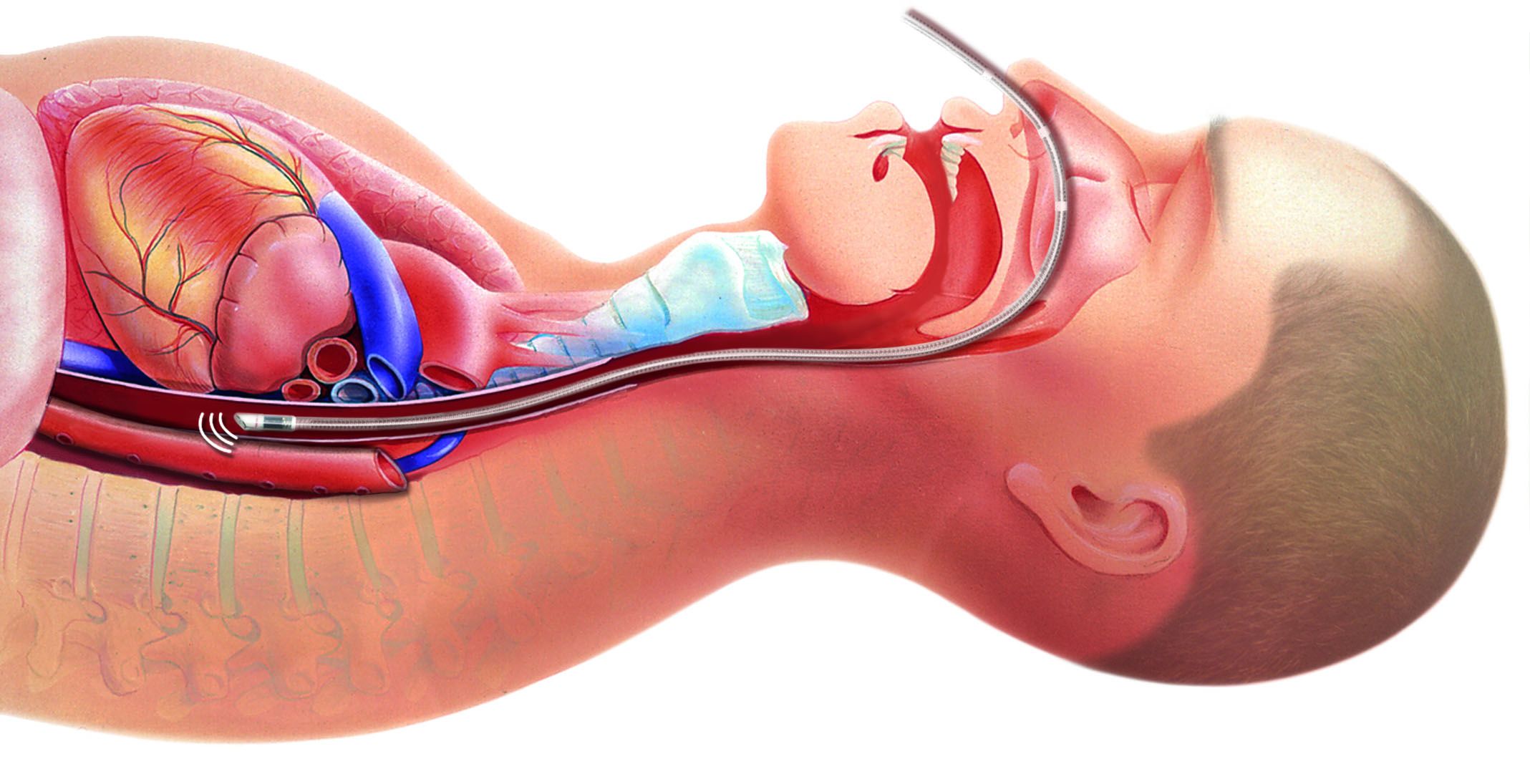Monitory do pomiarów hemodynamicznych serca i krwi DELTEX MEDICAL TRUEVUE ODM+