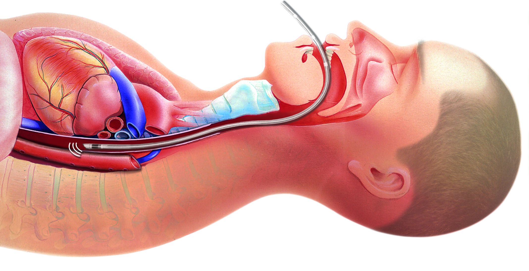 Monitory do pomiarów hemodynamicznych serca i krwi DELTEX MEDICAL TRUEVUE ODM+