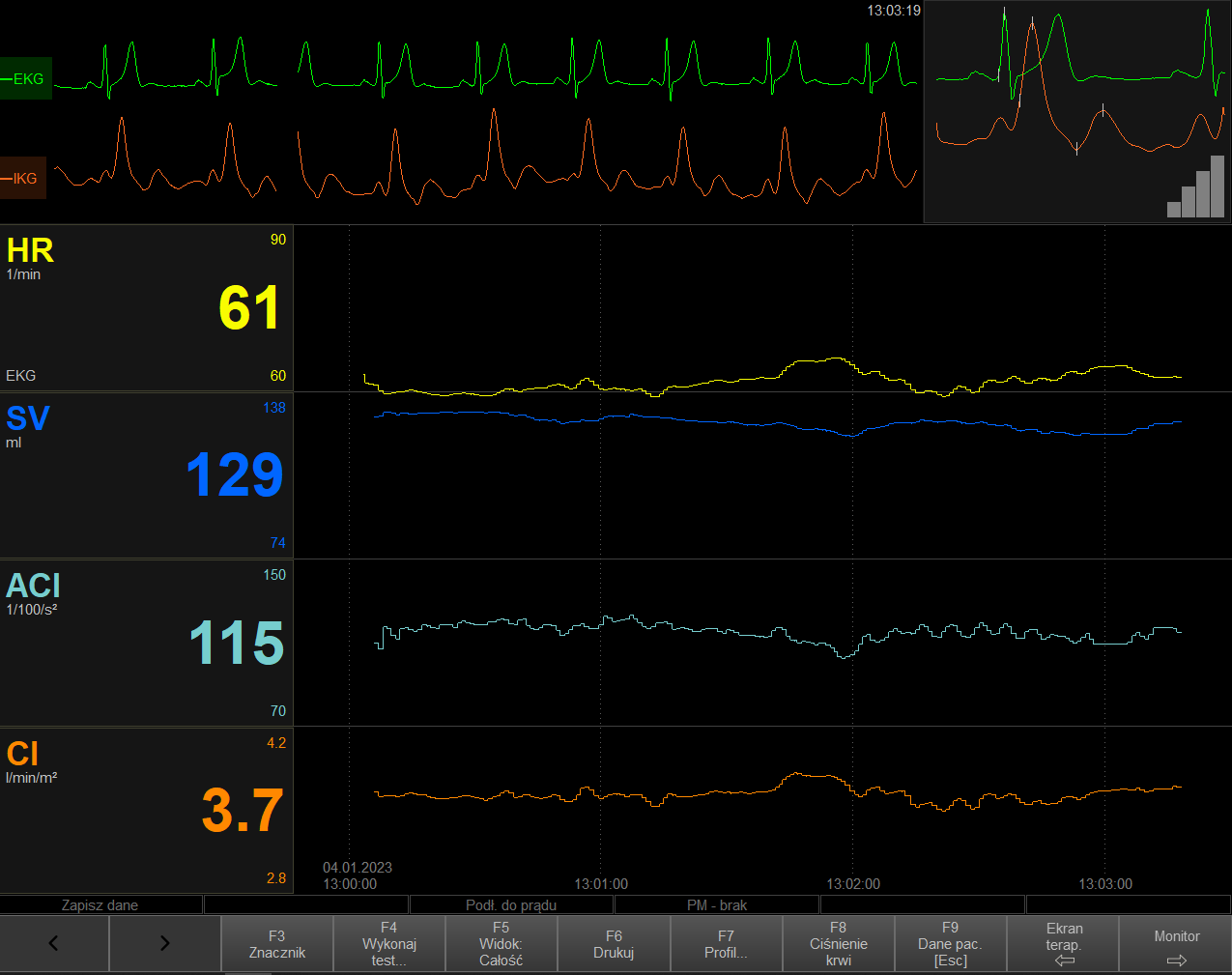 Monitory do pomiarów hemodynamicznych serca i krwi EM-MED CardioScreen 1000