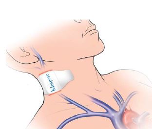 Monitory do pomiarów hemodynamicznych serca i krwi Mespere VENUS 2000 CVP