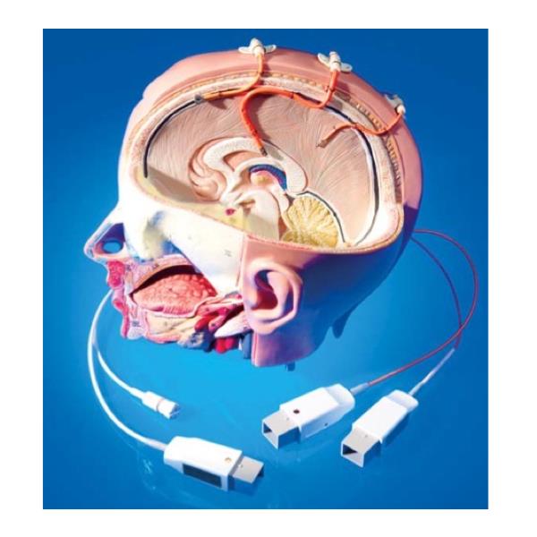 Monitory do pomiaru ciśnienia wewnątrzczaszkowego - Monitory ICP Raumedic AG NPS2