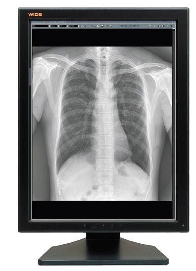 Monitory medyczne Ampronix Wide IF2103MP