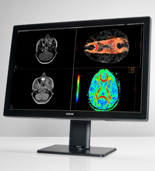 Monitory medyczne Barco Coronis Fusion