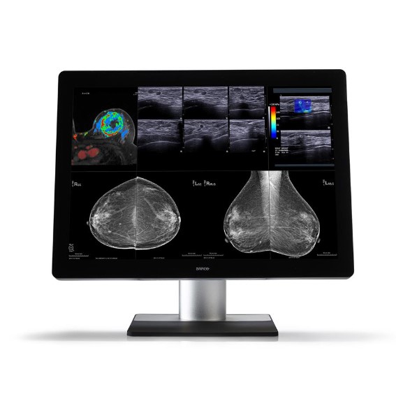 Monitory medyczne Barco Coronis Unity