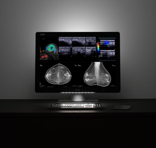 Monitory medyczne Barco Coronis Unity