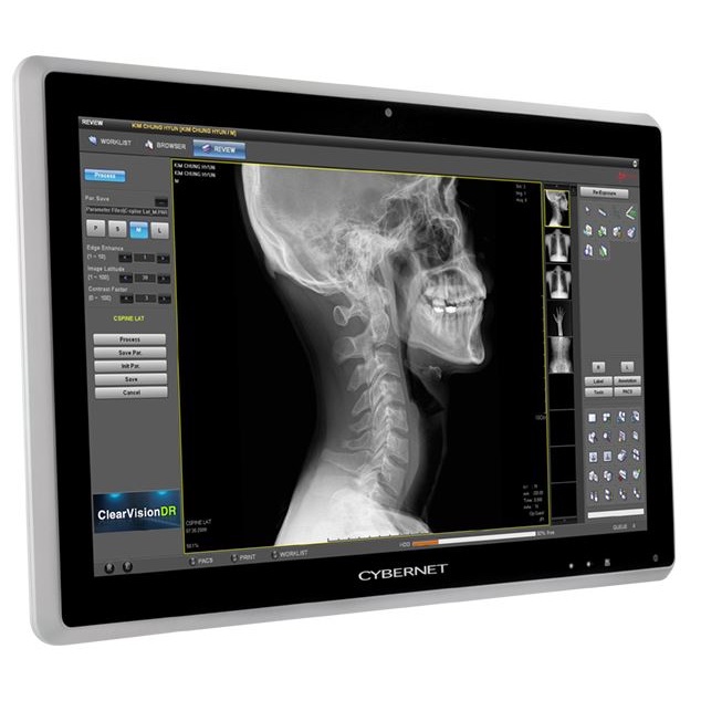 Monitory medyczne CyberMed CM-XB24