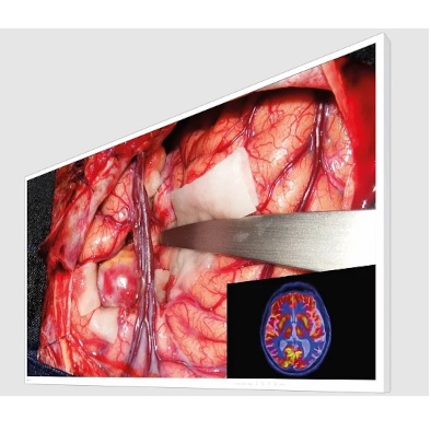 Monitory medyczne Eizo CuratOR EX5542