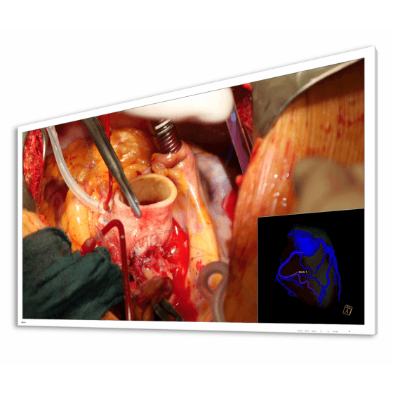 Monitory medyczne Eizo CuratOR EX5841