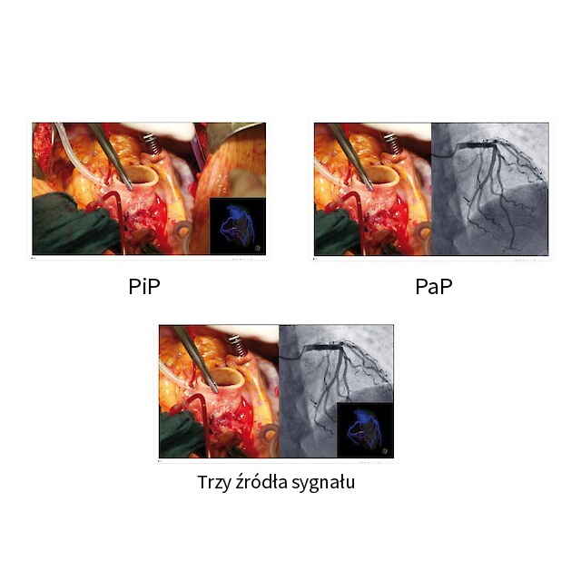 Monitory medyczne Eizo CuratOR EX5841