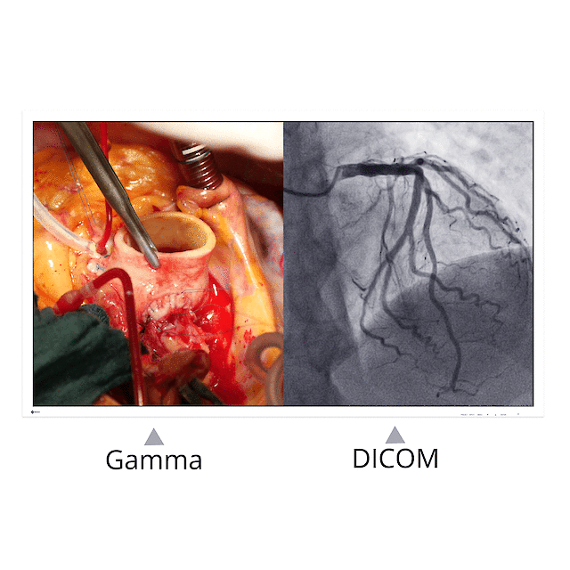Monitory medyczne Eizo CuratOR EX5841