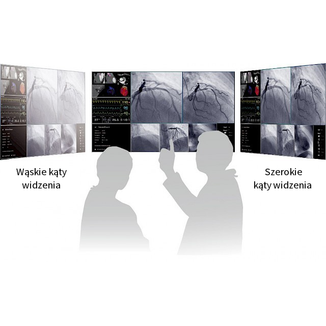 Monitory medyczne Eizo CuratOR LX491W