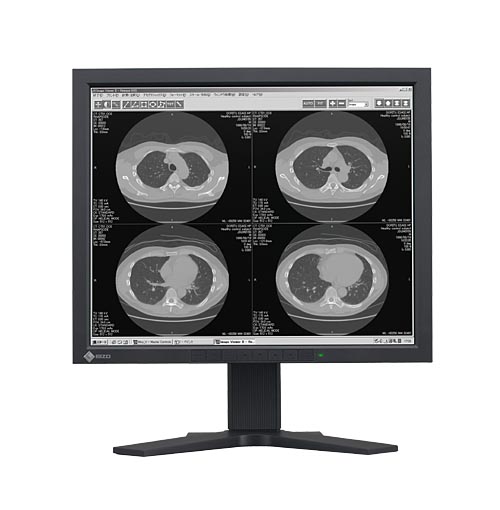 Monitory medyczne Eizo RadiForce G11