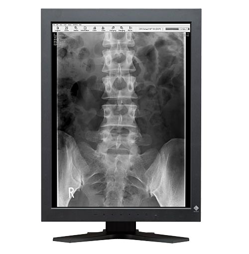 Monitory medyczne Eizo RadiForce GS220
