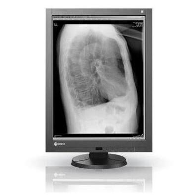 Monitory medyczne Eizo RadiForce GX240