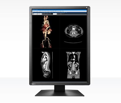 Monitory medyczne Eizo RadiForce MX216