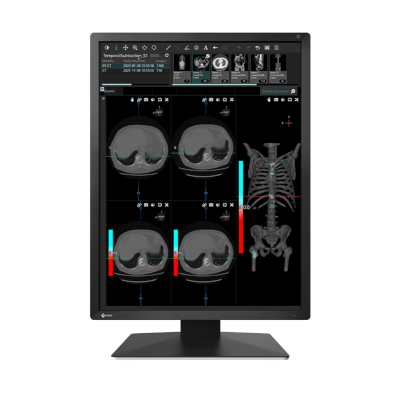 Monitory medyczne Eizo RadiForce MX217