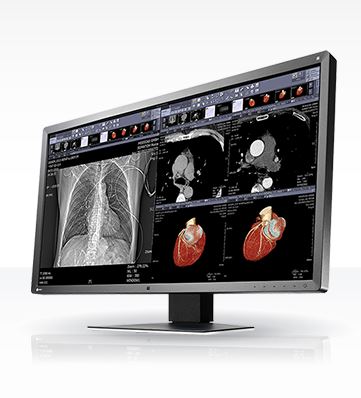 Monitory medyczne Eizo RadiForce MX315W
