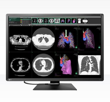 Monitory medyczne Eizo RadiForce RX1270