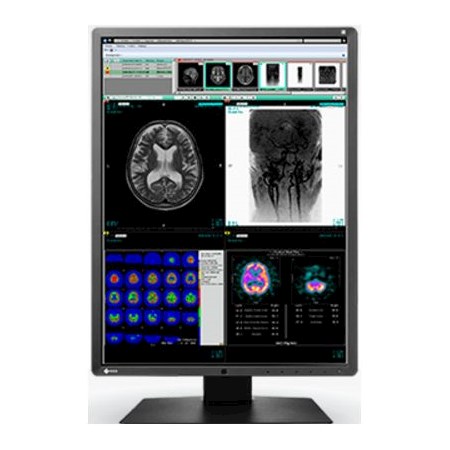Monitory medyczne Eizo RadiForce RX350