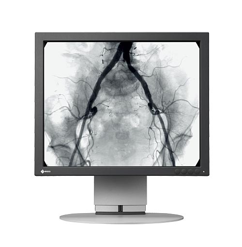 Monitory medyczne Eizo SMD 19102