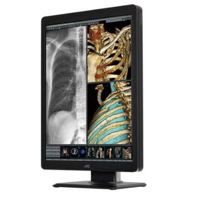 Monitory medyczne JVC CL-S200