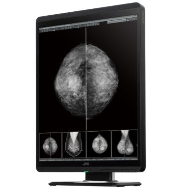 Monitory medyczne JVC MS-S500