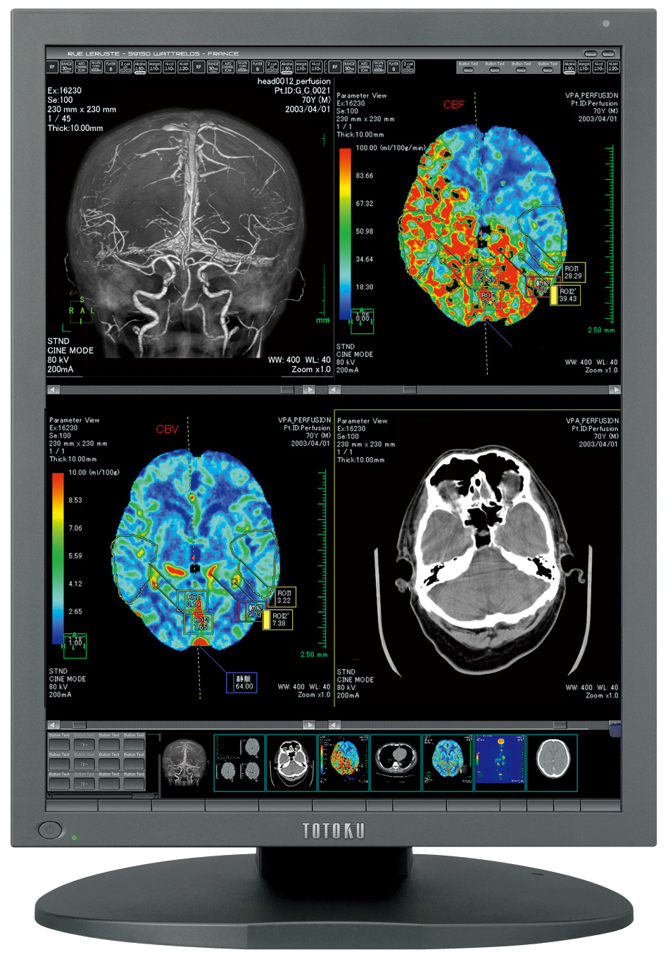 Monitory medyczne JVC TOTOKU CCL258i2