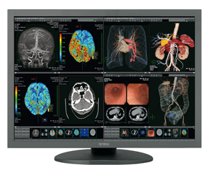 Monitory medyczne JVC TOTOKU CCL650i2