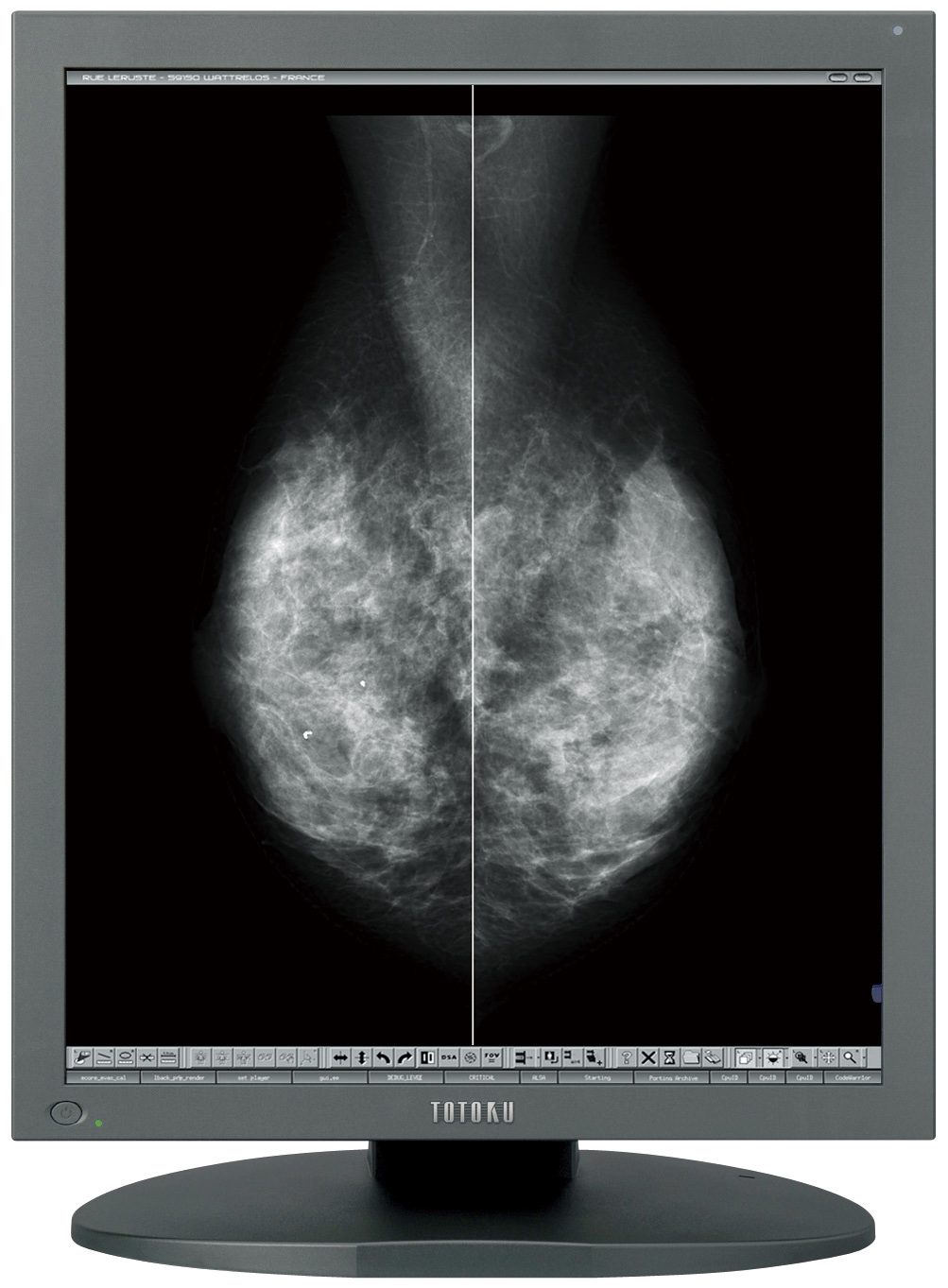 Monitory medyczne JVC TOTOKU MS55i2 plus