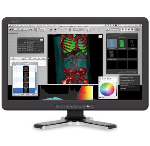 Monitory medyczne Kostec R270FBE