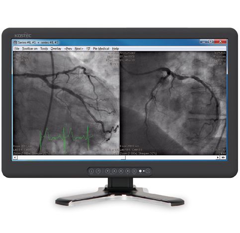 Monitory medyczne Kostec R270HBE