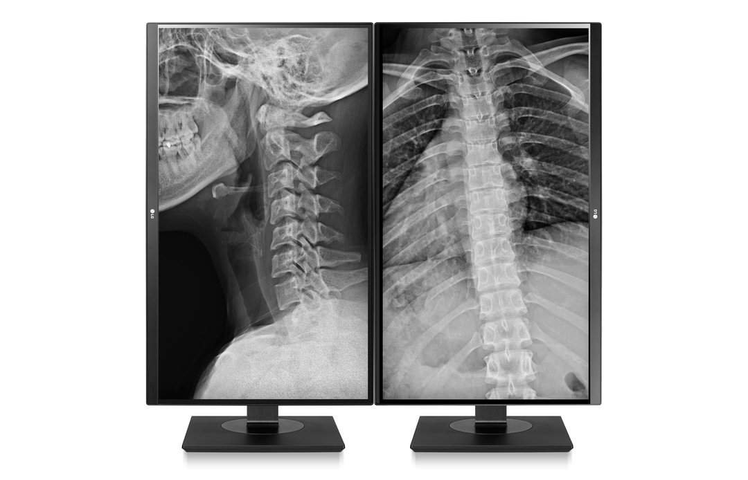 Monitory medyczne LG 27HJ713C