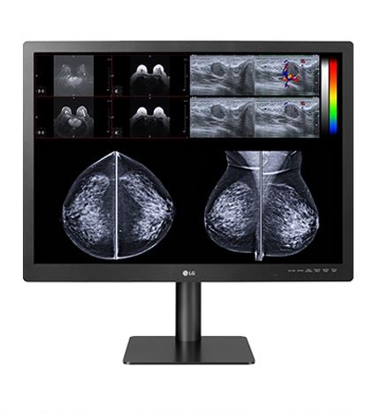 Monitory medyczne LG 31HN713D