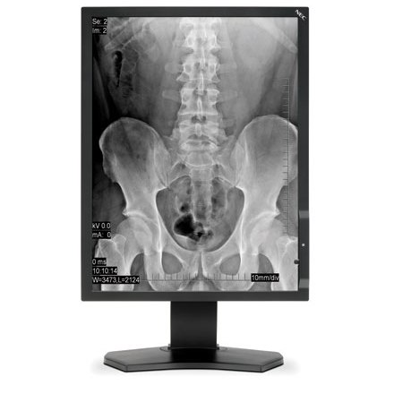 Monitory medyczne NEC MD211G3