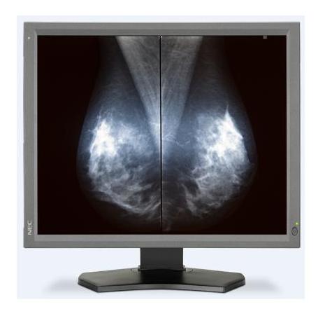 Monitory medyczne NEC MD211G5