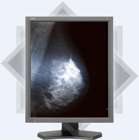 Monitory medyczne NEC MD211G5