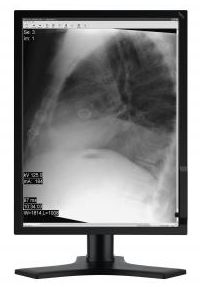 Monitory medyczne NEC MD213MG