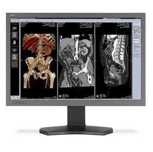 Monitory medyczne NEC MD302C6