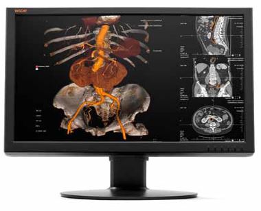 Monitory medyczne WIDE CL24S