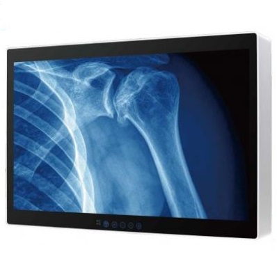 Monitory medyczne WINMATE M320TF 32 / M320TF-SDI 32