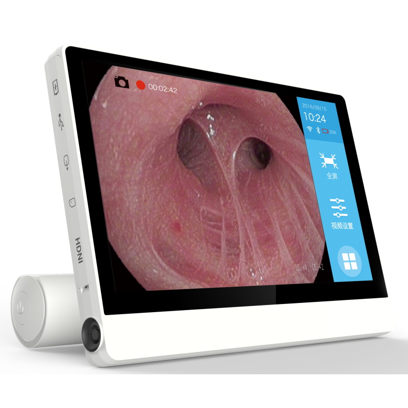 Nasofaryngoskopy (Videonasofaryngoskopy) Vision Medical EF28