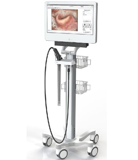 Nasofaryngoskopy (Videonasofaryngoskopy) XION EndoFLEX